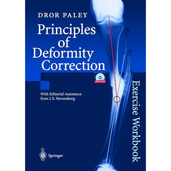 Principles of Deformity Correction 2003 Edition by Paley, Dror